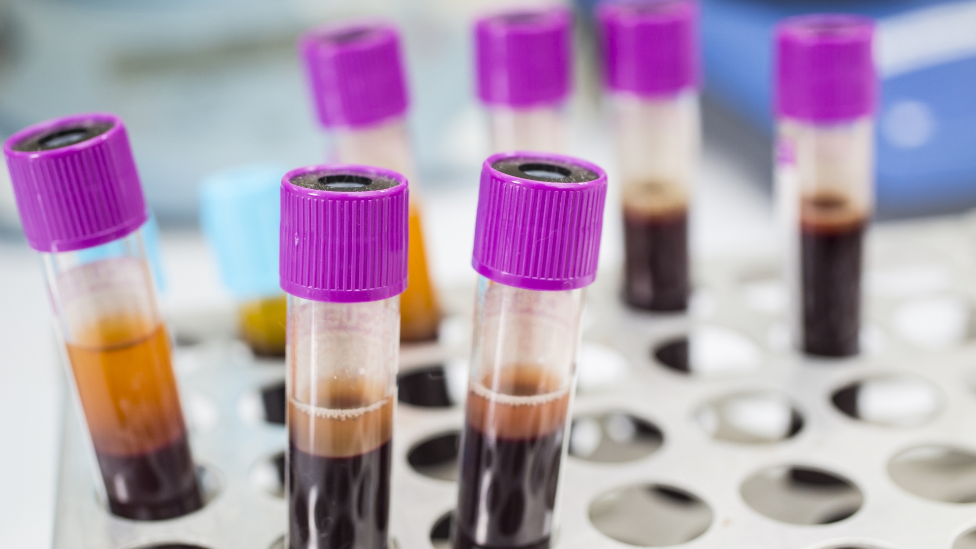CPD: Acute leukaemia – Essential Blood Cell Morphology